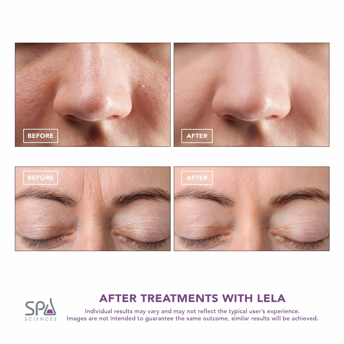 Spatula, Skin Spa LELA Sciences Mint