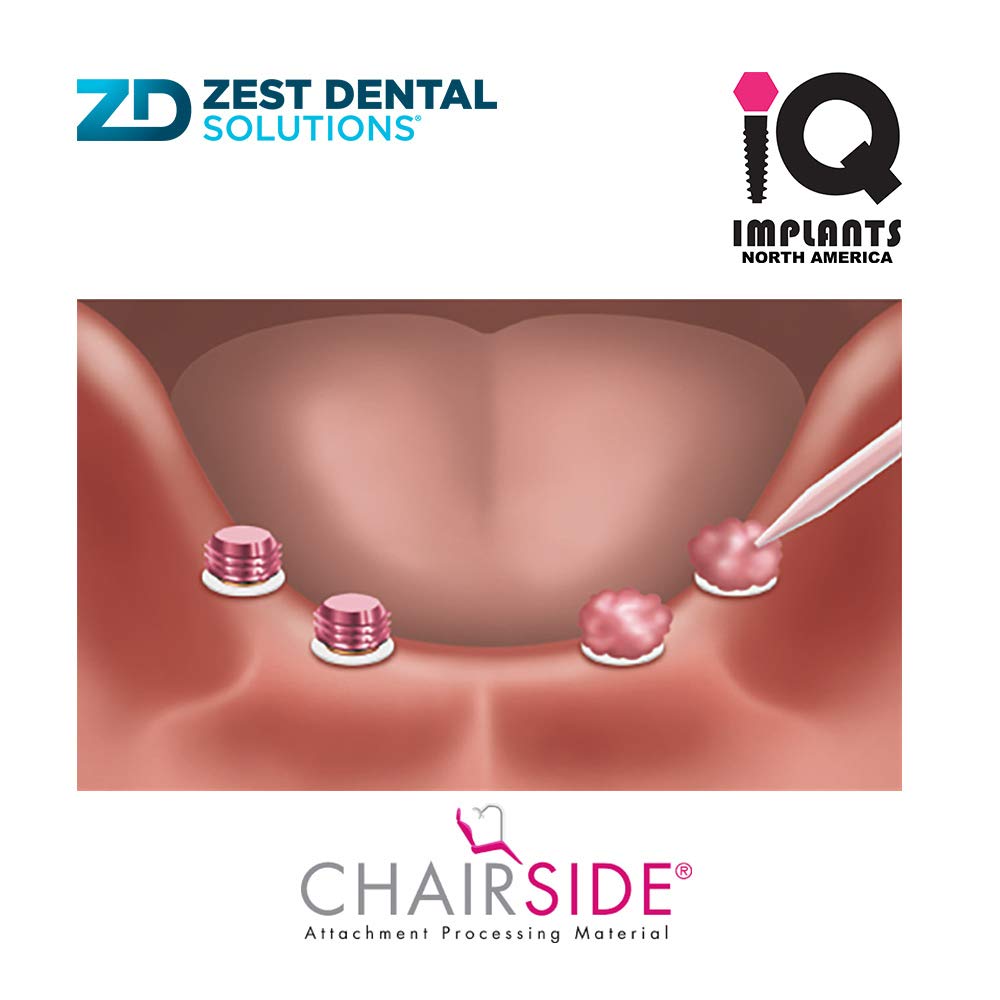 Zest CHAIRSIDE Attachment Processing Material 8gm, 4ml Fast Set