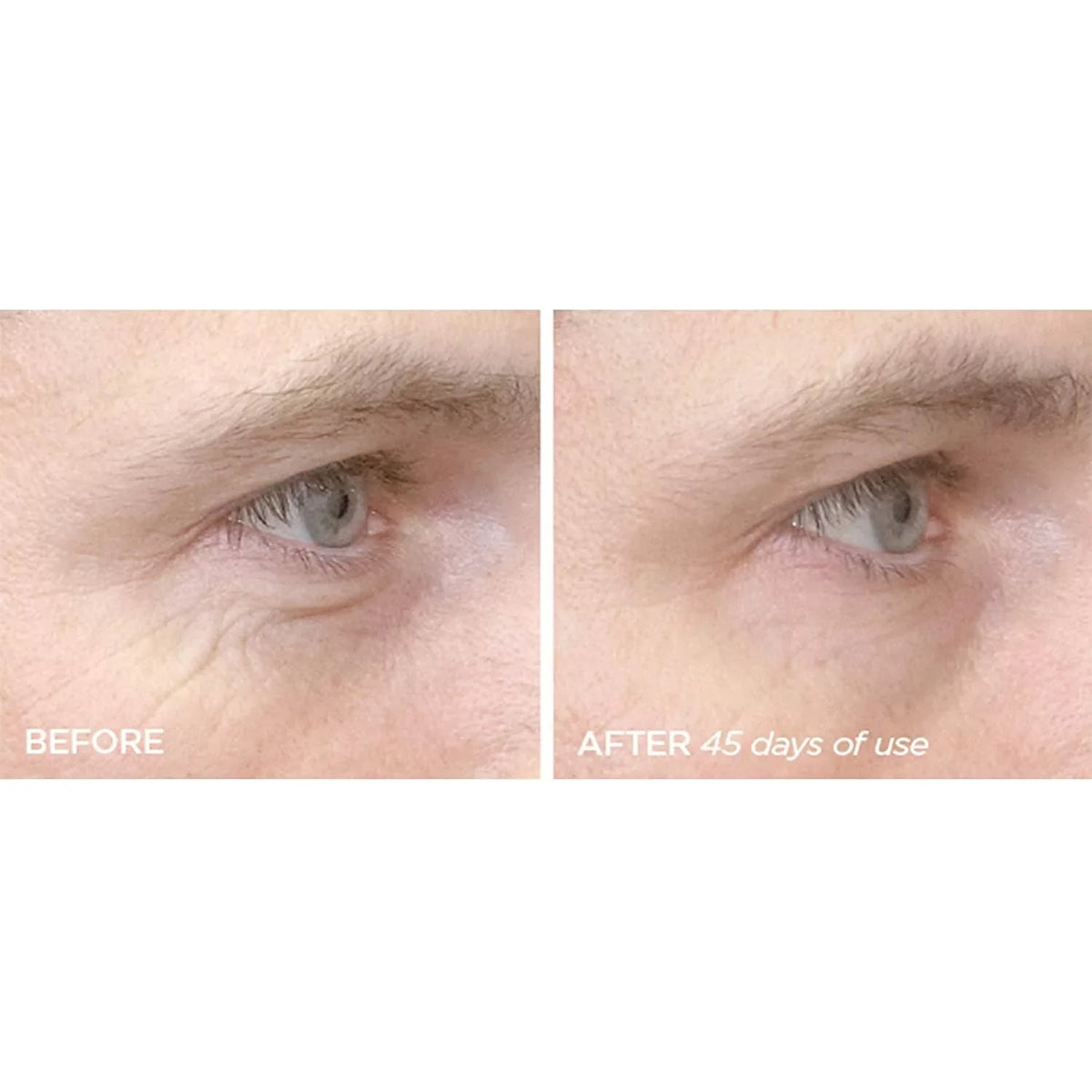 The 4B Treatment Reversal Phase Beauty & 4A Retinol Bioscience R45 Serum 2