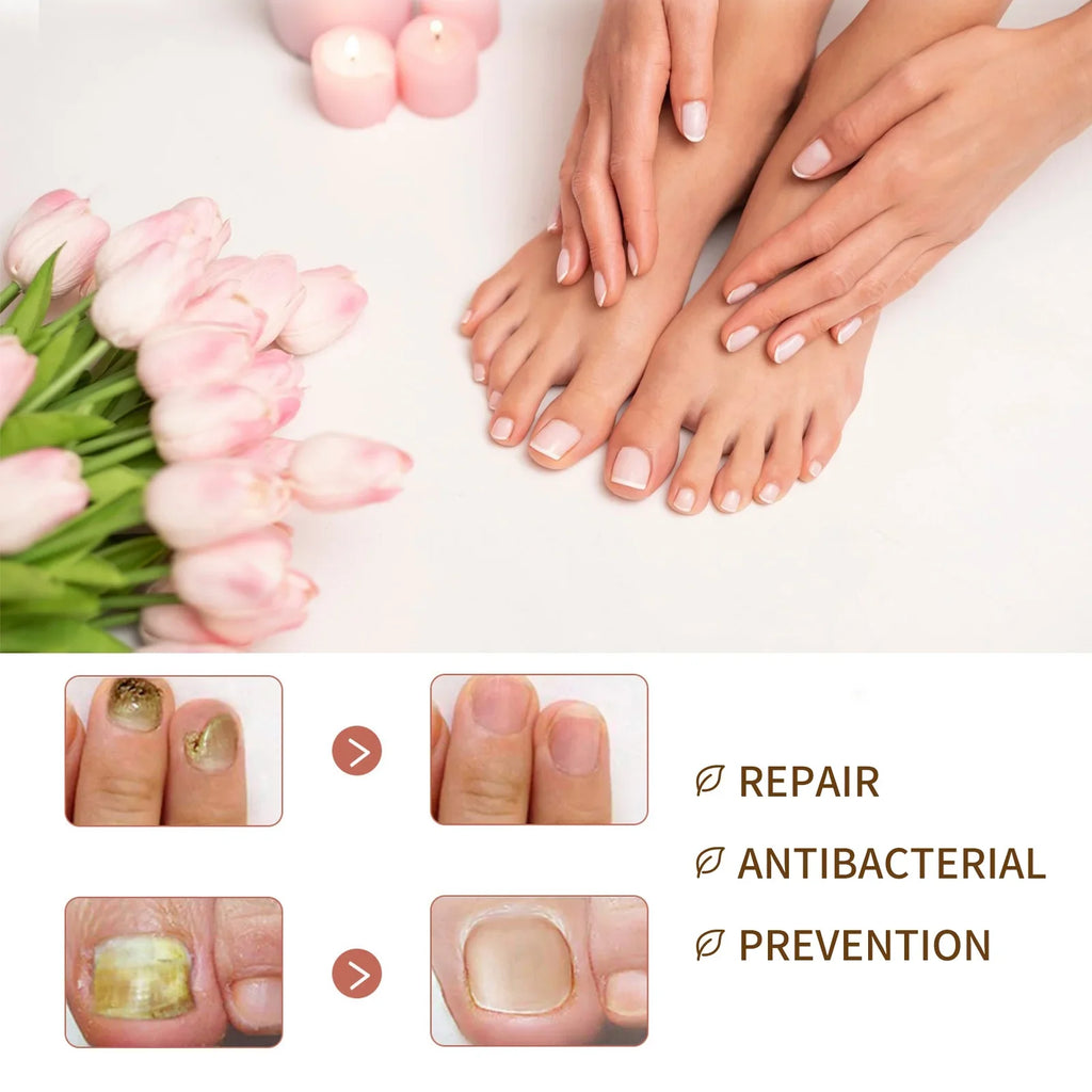 Growth Nail Growth Nails and and Growth Serum, Serum, Nail Reconstrux Nail Growth Repair Serum, Damaged Strengthening Nail Nail for Serum Organic Healing Nail for Growth, 3PCS Deep