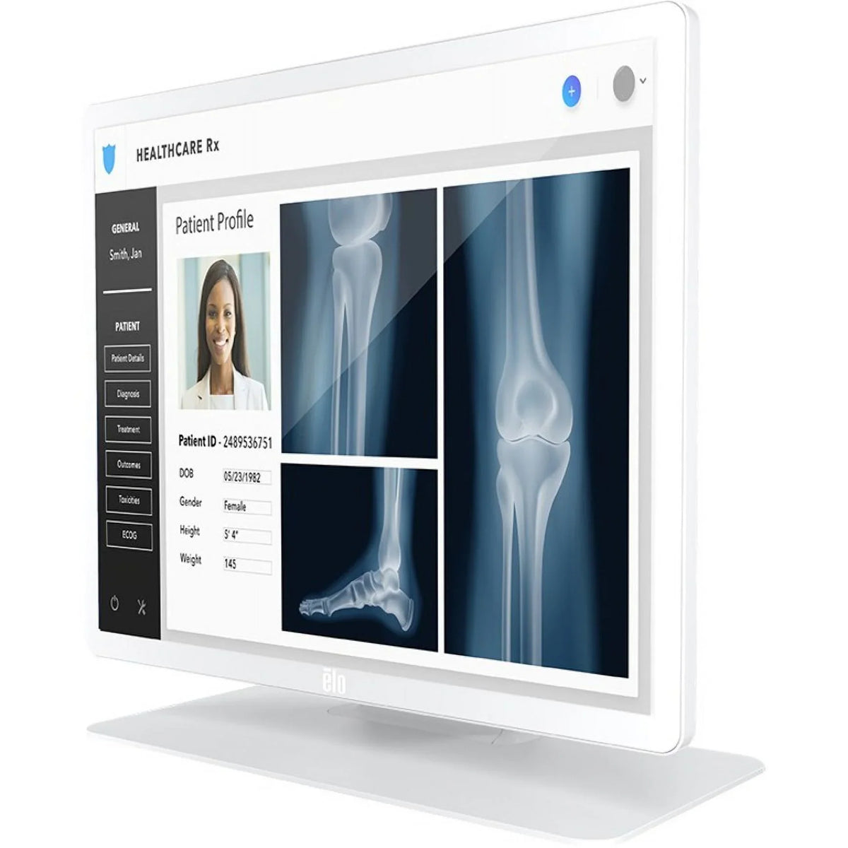 '- Projected LCD Class - ms Transistor -... - 1024 Point(s) Monitor - - 10 Nit 250 - Film Million 14 Colors 19" - Elo Capacitive 5:4 1280 Multi-touch 1903LM - - Thin Touchscreen 19" 16.7 x Screen (TFT)