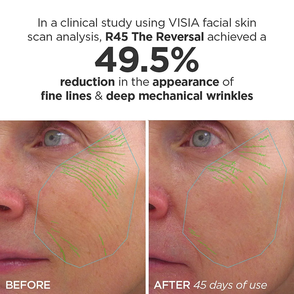 The 4B Treatment Reversal Phase Beauty & 4A Retinol Bioscience R45 Serum 2