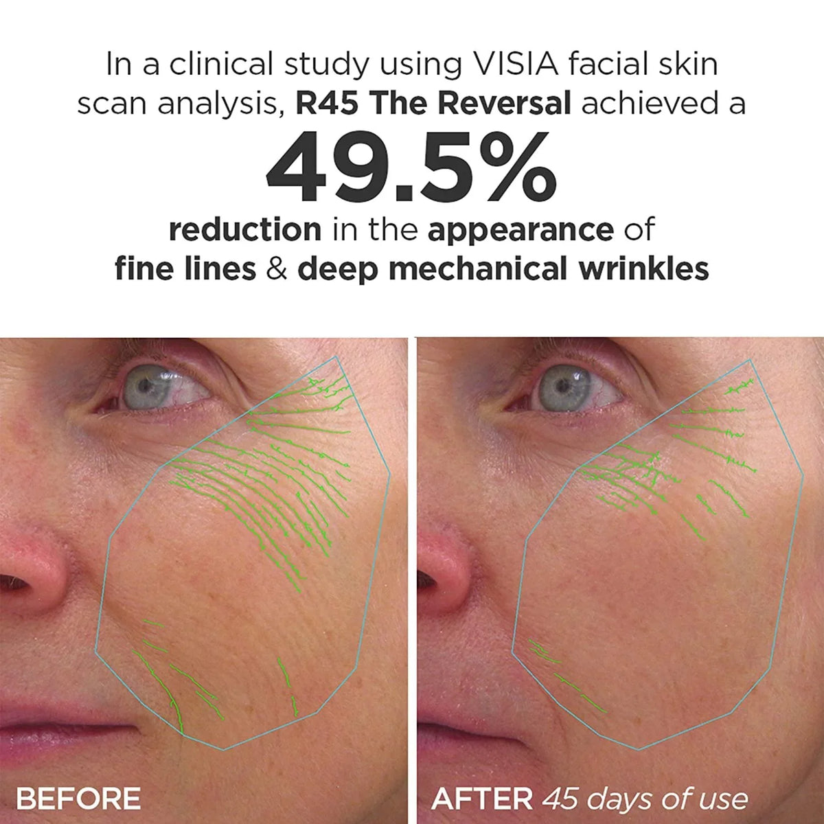 The 4B Treatment Reversal Phase Beauty & 4A Retinol Bioscience R45 Serum 2