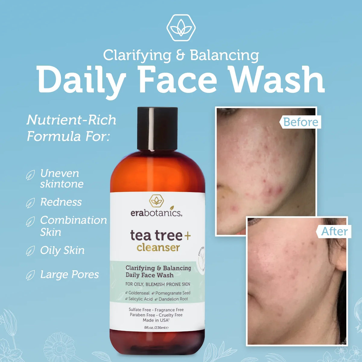 Cleanser Oil 8oz and Organics Tea Wash Tree Era Body Face