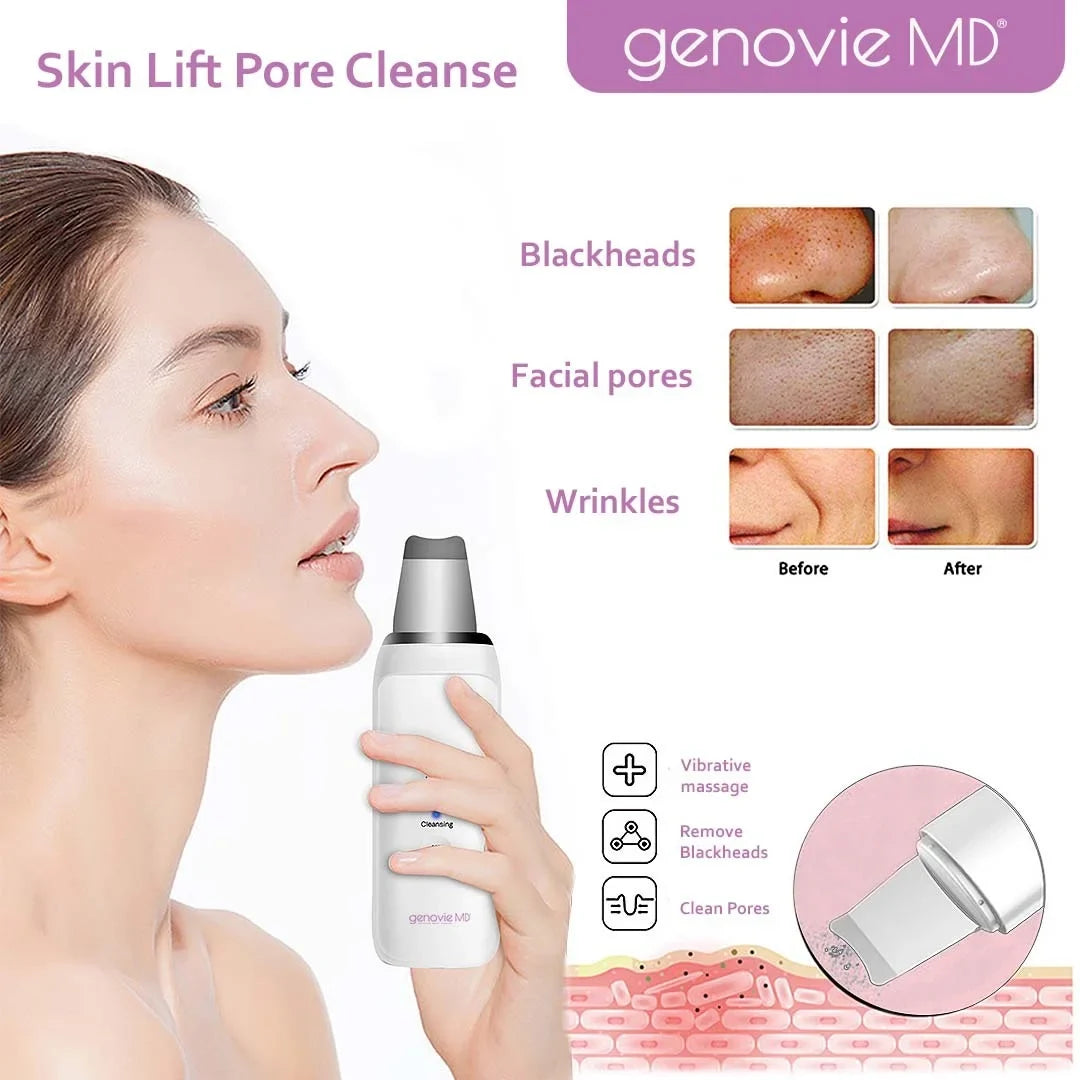 Face Pore Scrubber MD Cleanse, Facial Cleaning Skin Removal Remover, Tool, Acne And Genovie Blackhead Spatula, Deep