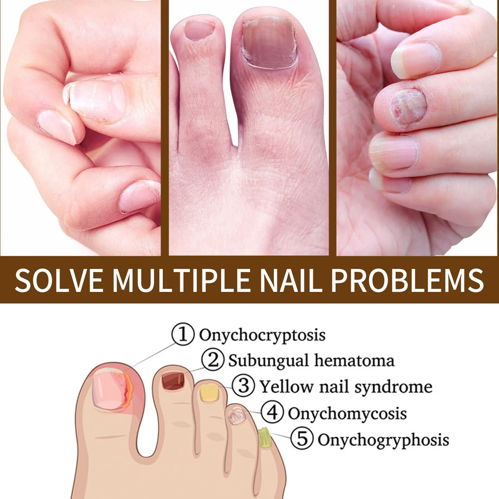 Growth Nail Growth Nails and and Growth Serum, Serum, Nail Reconstrux Nail Growth Repair Serum, Damaged Strengthening Nail Nail for Serum Organic Healing Nail for Growth, 3PCS Deep